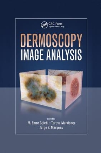 [object Object] «Dermoscopy Image Analysis» - фото №1