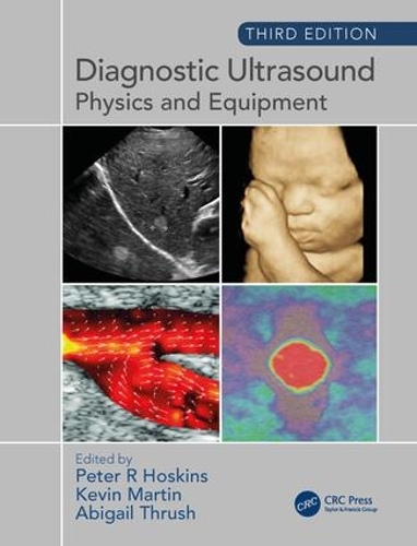 Паперова книга «Diagnostic Ultrasound, Third Edition: Physics and Equipment» - фото №1