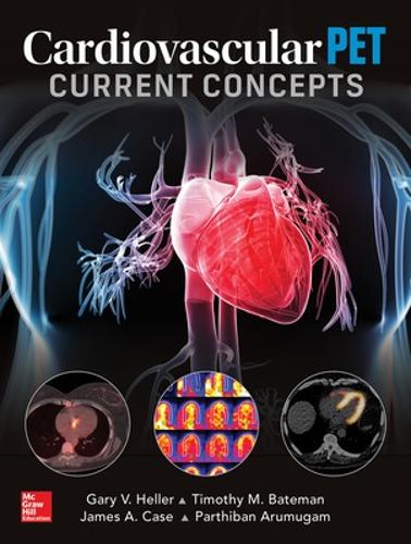 Бумажная книга «Cardiovascular PET: Current Concepts», автор Партибан Арумугам - фото №1