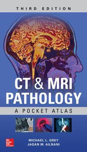 Бумажная книга «CT & MRI Pathology: A Pocket Atlas, Third Edition», автор Майкл Грей - фото №1