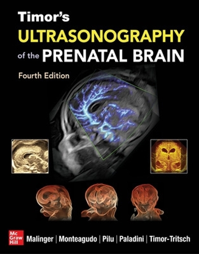 Бумажная книга «Timor's Ultrasonography of the Prenatal Brain, Fourth Edition», авторов Ана Монтеагудо, Дарио Паладини, Джанлуиджи Пилу, Густаво Малингер - фото №1