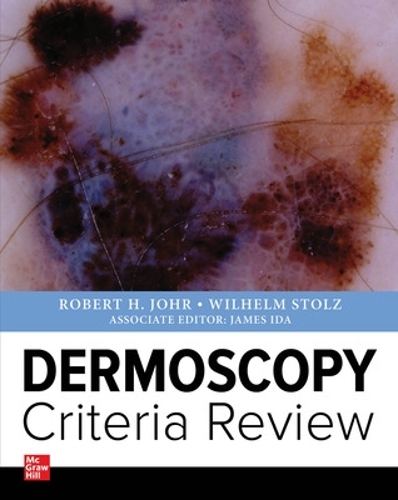 Бумажная книга «Dermoscopy  Criteria Review», автор Вильгельм Штольц - фото №1