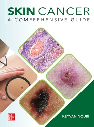 Бумажная книга «Skin Cancer: A Comprehensive Guide», автор Кейван Нури - фото №1