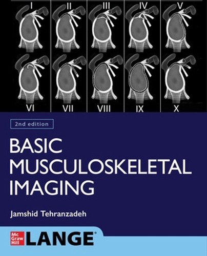 Бумажная книга «Basic Musculoskeletal Imaging, Second Edition», автор Джамшид Техранзаде - фото №1