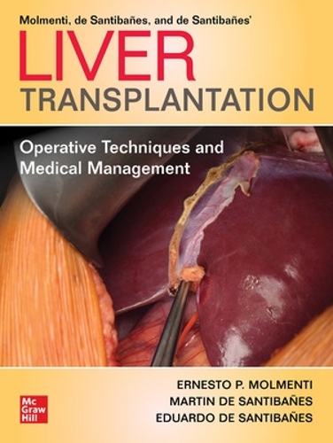 Бумажная книга «Liver Transplantation: Operative Techniques and Medical Management», автор Эрнесто П. Молменти - фото №1