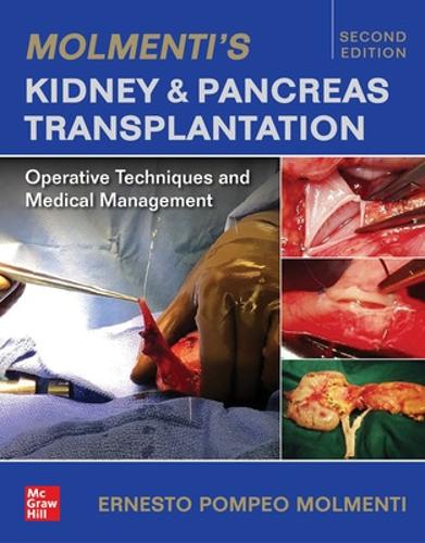 Бумажная книга «Molmenti's Kidney and Pancreas Transplantation: Operative Techniques and Medical Management», автор Эрнесто П. Молменти - фото №1