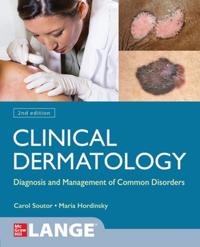 Бумажная книга «Clinical Dermatology: Diagnosis and Management of Common Disorders, Second Edition», автор Мария Хордински - фото №1