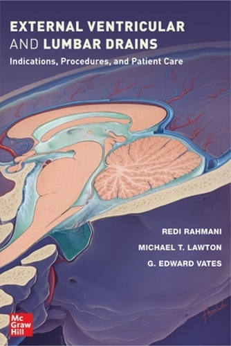 Паперова книга «External Ventricular and Lumbar Drains: Indications, Procedures, and Patient Care», автор Майкл Т. Лоутон - фото №1