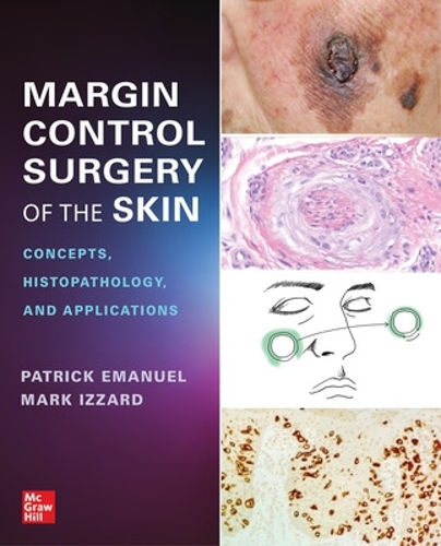 Бумажная книга «Margin Control Surgery of the Skin: Concepts, Histopathology, and Applications», автор Патрик Эмануэль - фото №1