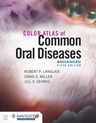 Бумажная книга «Color Atlas Of Common Oral Diseases, Enhanced Edition», авторов Крейг С. Миллер, Джил С. Гериг, Роберт П. Лангле - фото №1