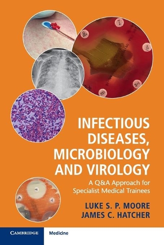 Бумажная книга «Infectious Diseases, Microbiology and Virology: A Q&A Approach for Specialist Medical Trainees», авторов Джеймс К. Хэтчер, Люк С. П. Мур - фото №1