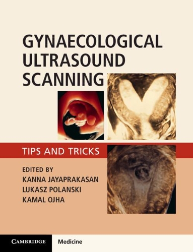 Паперова книга «Gynaecological Ultrasound Scanning: Tips and Tricks», авторів Камал Оджа, Канна Джаяпракасан, Лукаш Поланські - фото №1