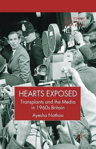 Бумажная книга «Hearts Exposed: Transplants and the Media in 1960s Britain», автор А. Нату - фото №1
