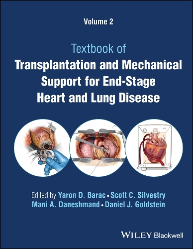Паперова книга «Transplantation and Mechanical Support for End-Stage Heart and Lung Disease, Volume 2» - фото №1