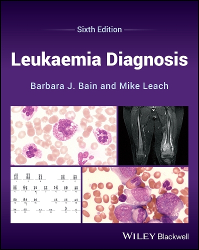 Бумажная книга «Leukaemia Diagnosis», авторов Барбара Дж. Бэйн, Майк Лич - фото №1