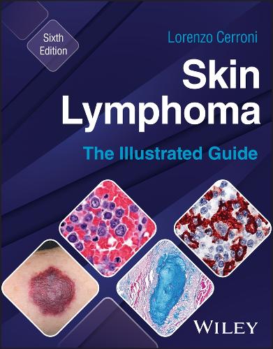 Бумажная книга «Skin Lymphoma: The Illustrated Guide», автор Лоренцо Серрони - фото №1