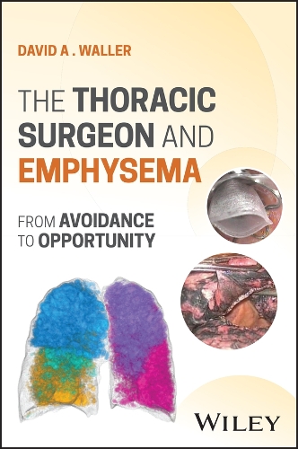 Paper book «The Thoracic Surgeon and Emphysema: From Avoidance to Opportunity», author David A. Waller - фото №1