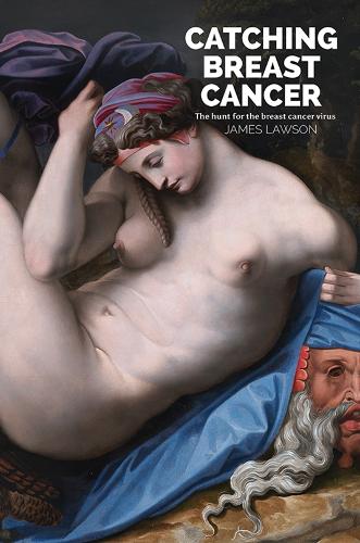 Бумажная книга «Catching Breast Cancer: The hunt for the breast cancer virus», автор Джеймс Лоусон - фото №1