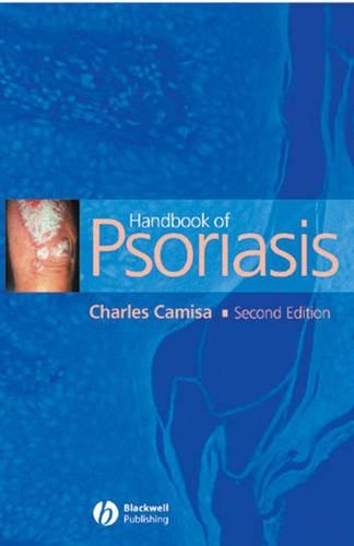 Паперова книга «Handbook of Psoriasis», автор Чарльз Каміза - фото №1