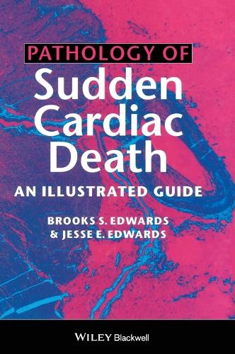 Бумажная книга «Pathology of Sudden Cardiac Death: An Illustrated Guide», авторов Брукс С. Эдвардс, Джесси Э. Эдвардс - фото №1