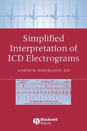 Паперова книга «Simplified Interpretation of ICD Electrograms», автор Аарон Б. Гессельсон - фото №1