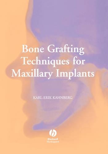 Паперова книга «Bone Grafting Techniques for Maxillary Implants», автор Карл-Ерік Канберг - фото №1