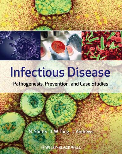 Паперова книга «Infectious Disease: Pathogenesis, Prevention and Case Studies», авторів Джуліан В. Танг, Джулі Ендрюс, Нандіні Шетті - фото №1