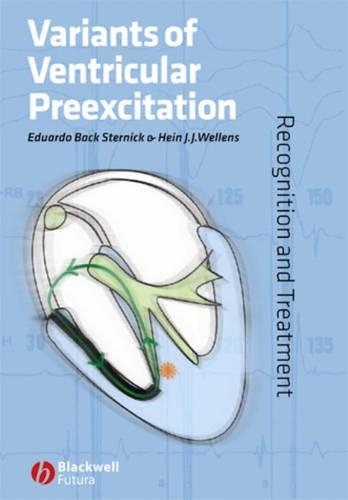 Бумажная книга «Variants of Ventricular Preexcitation: Recognition and Treatment», авторов Эдуардо Бэк Стерник, Хайн Й. Й. Велленс - фото №1
