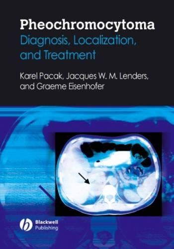 Бумажная книга «Pheochromocytoma: Diagnosis, Localization, and Treatment», авторов Грэм Айзенхофер, Жак Лендерс, Карел Пакак - фото №1