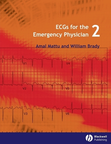 Паперова книга «ECGs for the Emergency Physician 2», авторів Амаль Матту, Вільям Джей Брейді - фото №1
