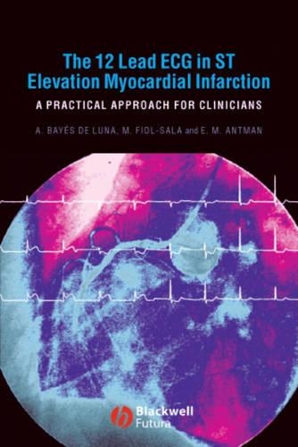 Бумажная книга «The 12 Lead ECG in ST Elevation Myocardial Infarction: A Practical Approach for Clinicians», авторов Антони Байес де Луна, Эллиот М. Антман, Микель Фиол-Сала - фото №1