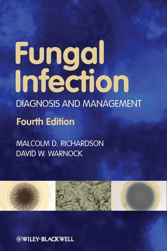 Бумажная книга «Fungal Infection: Diagnosis and Management», авторов Дэвид У. Уорнок, Малкольм Д. Ричардсон - фото №1