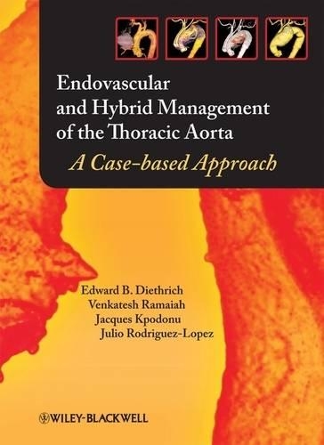 Бумажная книга «Endovascular and Hybrid Management of the Thoracic Aorta: A Case-based Approach», авторов Эдвард Б. Дитрих, Жак Кподону, Хулио А. Родригес-Лопес, Венкатеш Рамайя - фото №1