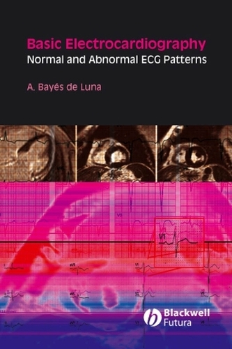 Бумажная книга «Basic Electrocardiography: Normal and Abnormal ECG Patterns», автор Антони Байес де Луна - фото №1