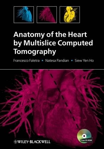 Паперова книга «Anatomy of the Heart by Multislice Computed Tomography», авторів Франческо Фалетра, Натеса Пандіан, Сів Єн Хо - фото №1