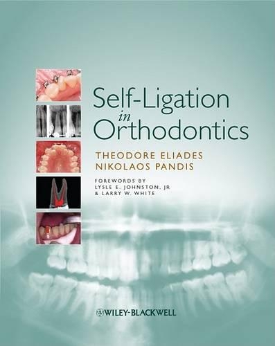 Бумажная книга «Self-Ligation in Orthodontics», авторов Николаос Пандис, Теодор Элиадес - фото №1