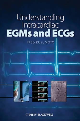 Паперова книга «Understanding Intracardiac EGMs and ECGs», автор Фред М. Кусумото - фото №1