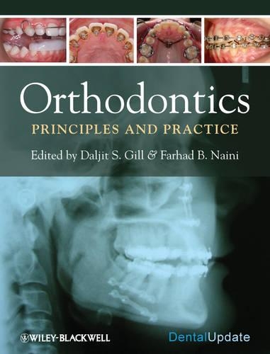 Паперова книга «Orthodontics: Principles and Practice», авторів Далжит С. Гілл, Фархад Б. Найні - фото №1