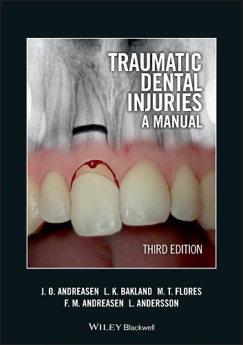 Паперова книга «Traumatic Dental Injuries: A Manual», авторів Френсіс М. Андреасен, Йенс О. Андреасен, Ларс Андерссон, Лейф К. Бакланд, Марія Тереза Флорес - фото №1