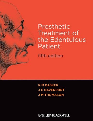 Паперова книга «Prosthetic Treatment of the Edentulous Patient», авторів Дж. К. Девенпорт, Дж. М. Томасон, Р. М. Баскер - фото №1