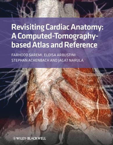 Бумажная книга «Revisiting Cardiac Anatomy: A Computed-Tomography-Based Atlas and Reference», автор Фархуд Сареми - фото №1