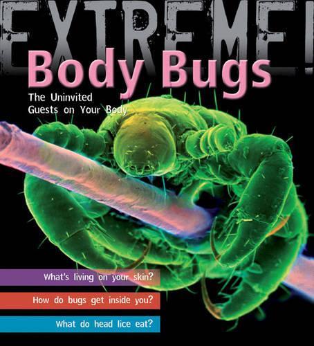 [object Object] «Extreme Science: Body Bugs!: The Uninvited Guests on Your Body», автор Тревор Дей - фото №1