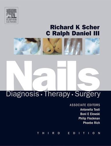 Паперова книга «Nails: Diagnosis, Therapy, Surgery», авторів К. Ральф Деніел, Річард К. Шер - фото №1
