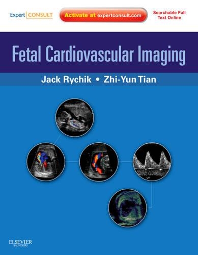Паперова книга «Fetal Cardiovascular Imaging: A Disease Based Approach: Expert Consult Premium Edition: Enhanced Online Features and Print», авторів Джек Ричик, Чжіюнь Тянь - фото №1