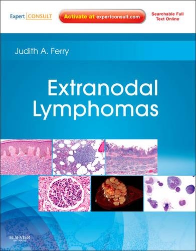 Паперова книга «Extranodal Lymphomas: Expert Consult - Online and Print», автор Джудіт А. Феррі - фото №1