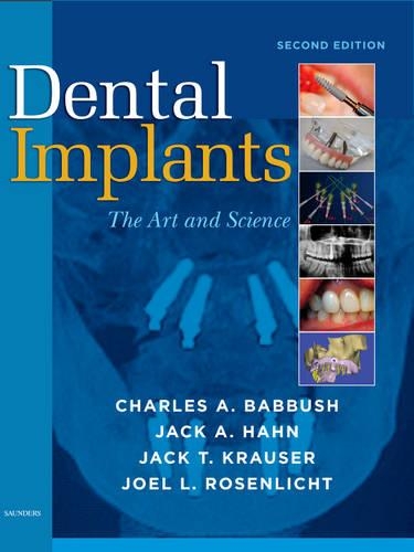Паперова книга «Dental Implants: The Art and Science», авторів Чарльз А. Беббуш, Джек А. Хан, Джек Т. Краузер, Джоел Л. Розенліхт - фото №1