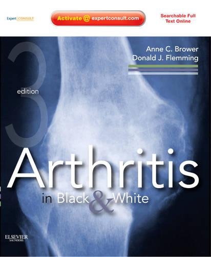 Бумажная книга «Arthritis in Black and White: Expert Consult - Online and Print», авторов Энн К. Броуэр, Дональд Дж. Флемминг - фото №1