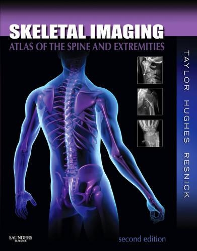 Бумажная книга «Skeletal Imaging: Atlas of the Spine and Extremities», авторов Дональд Л. Резник, Джон А. М. Тейлор, Тудор Х. Хьюз - фото №1