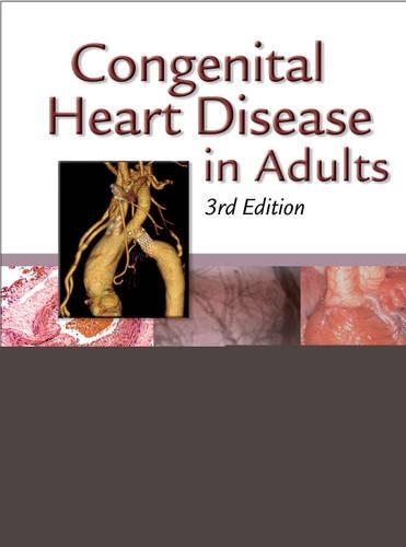 Паперова книга «Congenital Heart Disease in Adults», авторів Джаміль Абульхосн, Джон С. Чайлд, Джозеф К. Перлофф - фото №1
