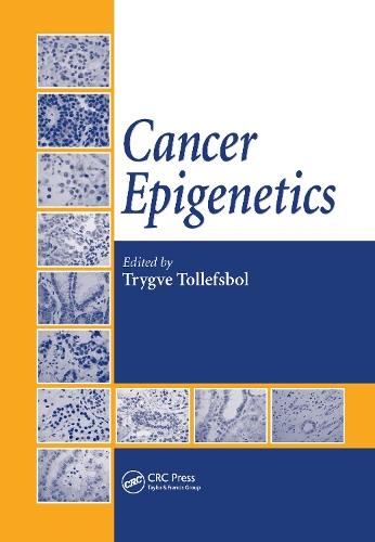 Бумажная книга «Cancer Epigenetics» - фото №1